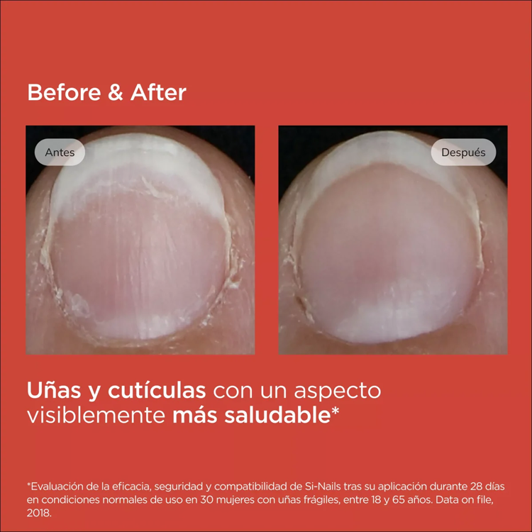 Imagen de Isdin Fortalecedor De Uñas Si Nails Varnish 2.5 Ml